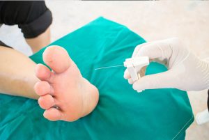 Neuropathy Relief Miami. Sensory Neuropathy Symptoms, Causes, and Treatment? This condition can be caused by a variety of factors, including diabetes, chemotherapy, and certain medications. In this blog, we'll discuss what sensory neuropathy is, its symptoms, causes, and treatment options.