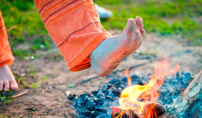 Burning Foot - Neuropathy Relief Miami