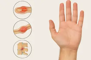 Numbness in Hands - Medical illustration showing a human hand next to three circular insets highlighting inflammation and nerve compression, representing common causes of hand numbness like carpal tunnel syndrome, peripheral neuropathy, and cervical radiculopathy.