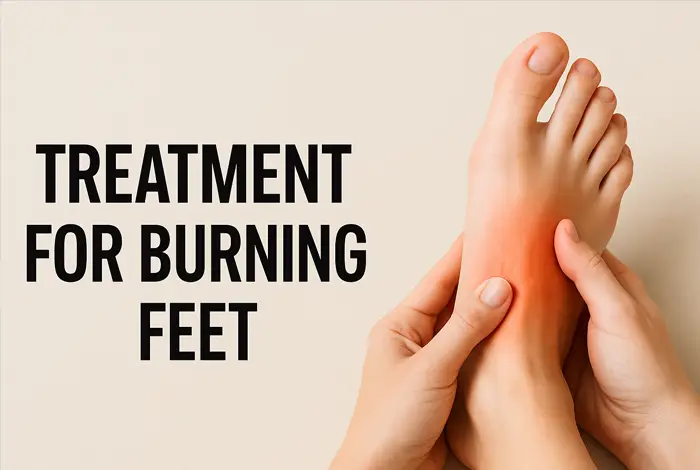 Hands gently holding a bare foot with visible redness on the sole, representing a burning sensation; beige background with the text “Treatment for Burning Feet” on the left.